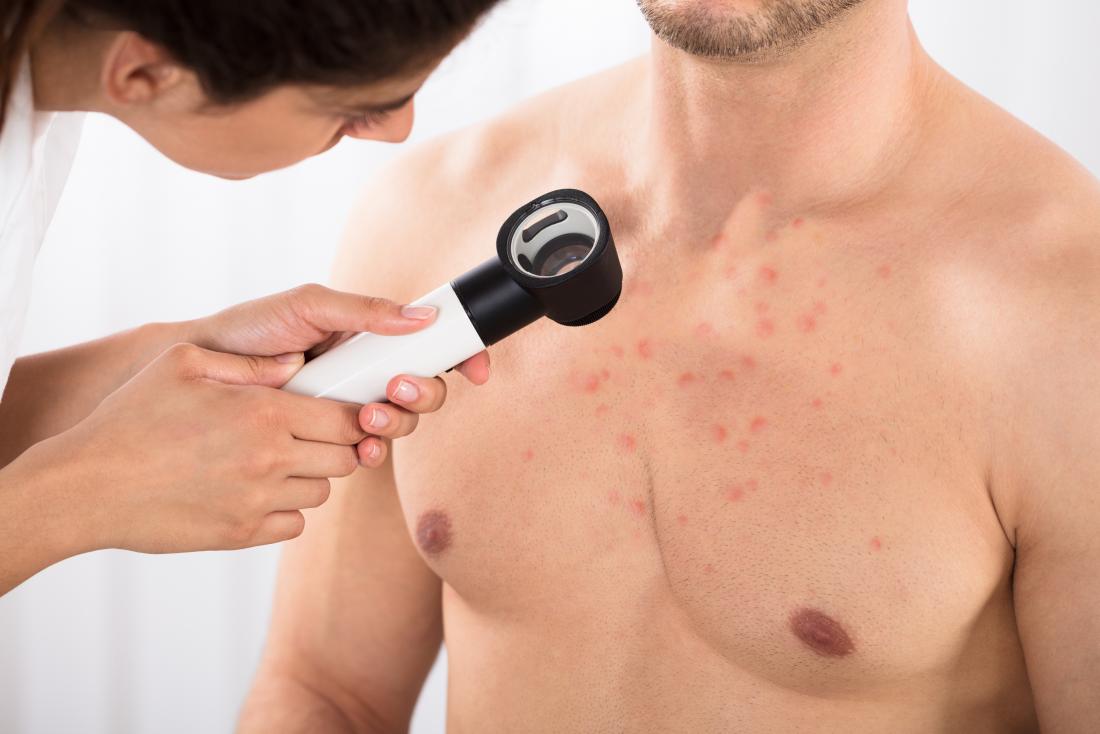doctor-examining-man-with-acne-on-his-chest.jpg