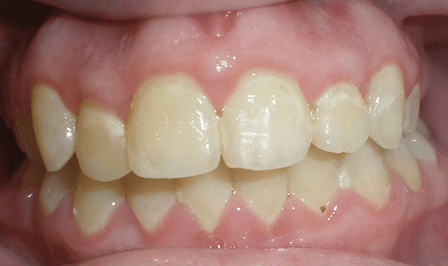 www.dentalproductsreport.com