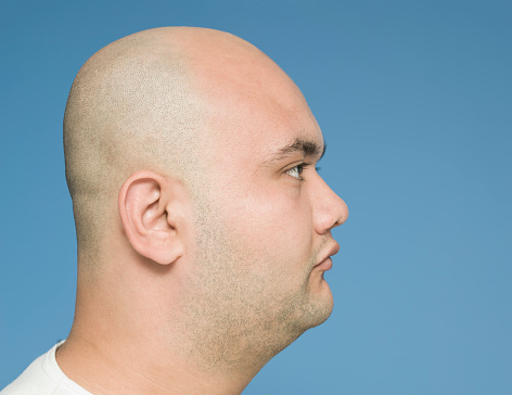 side-view-of-bald-head-picture-id499175822