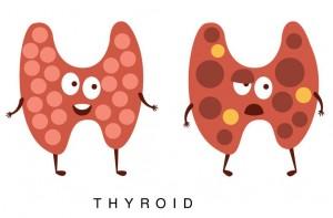 thyroid-symptoms-in-women-300x197.jpg